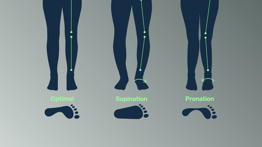 Supination Insoles: A Complete Guide to Realigning Comfort and Stability
