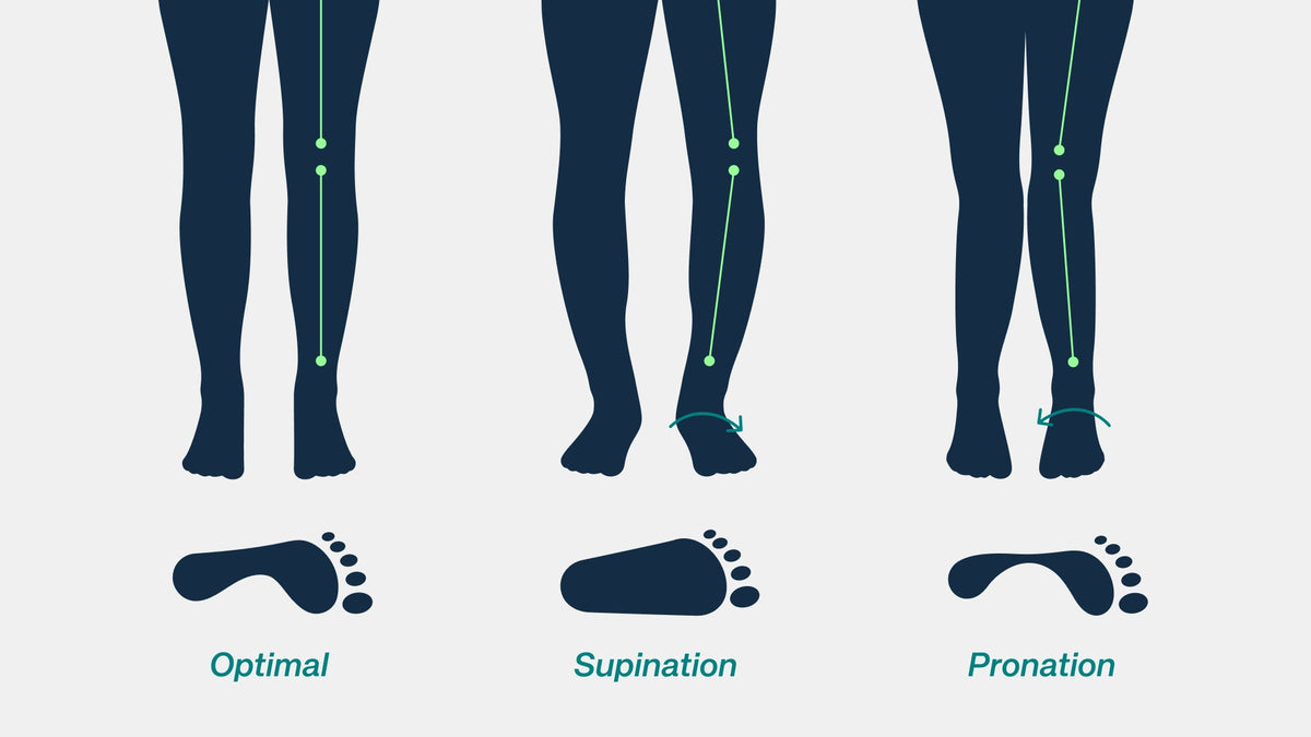 Supination Insoles: A Complete Guide to Realigning Comfort and Stability