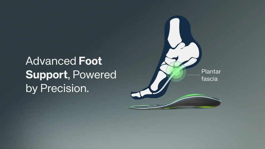 Why Runners Shouldn’t Ignore Everyday Foot Support